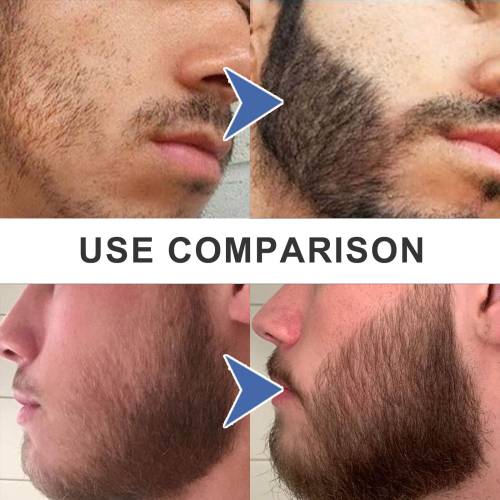 3-in-1 Beard Filler Pen Set