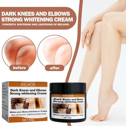 Brightening Cream for Elbows & Knees with Glutathione & Kojic Acid
