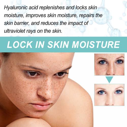 Moisturizing Face Cream for Spots & Dullness