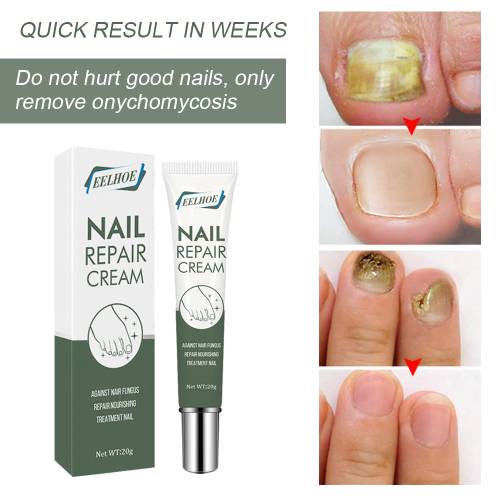 Botanical Nail Cream