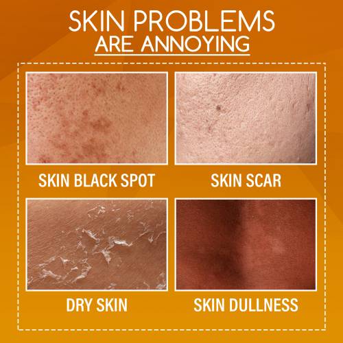 Orange Peel Body Lotion with Vitamin C & Centella