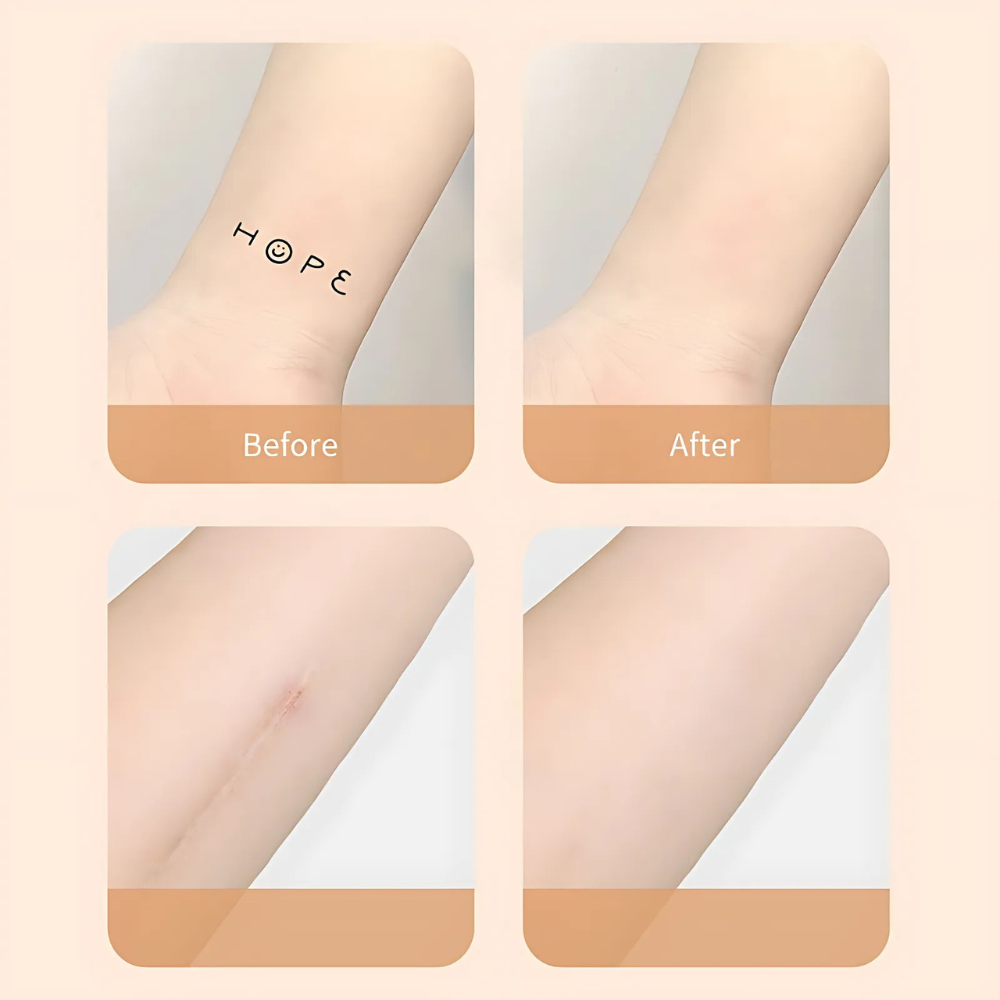 zavevo | Scar Concealer Patch Waterproof Skin Cover
